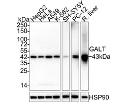 GALT Antibody (PSH02-87), Novus Biologicals 100 &mu;L; Unconjugated:Antibodies,