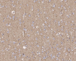 GAT-1/SLC6A1 Antibody (JE34-61), Novus Biologicals 100 &mu;L; Unconjugated:Antibodies,