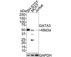 GATA-3 Antibody (A3G3-R), Novus Biologicals 100 &mu;L | Buy Online | Novus Biologicals | Fisher Scientific