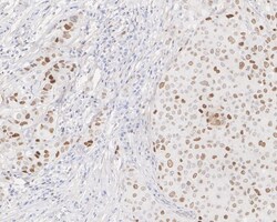 GATA-3 Antibody (A3G3-R), Novus Biologicals 100 &mu;L | Buy Online | Novus Biologicals | Fisher Scientific