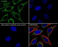 HABP1/C1QBP/GC1q R Antibody (A8F4-R), Novus Biologicals 100 &mu;L; Unconjugated:Antibodies,