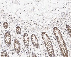 HABP1/C1QBP/GC1q R Antibody (A8F4-R), Novus Biologicals 100 &mu;L; Unconjugated:Antibodies,