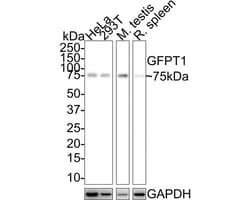 GFPT1 Antibody (JE43-68), Novus Biologicals 100 &mu;L; Unconjugated:Anticorps,