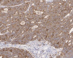 GFPT1 Antibody (JE43-68), Novus Biologicals 100 &mu;L; Unconjugated:Anticorps,