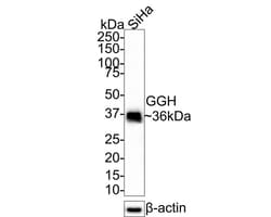 gamma-glutamyl hydrolase Antibody (JE61-78), Novus Biologicals 100 &mu;L;