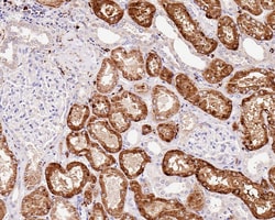 gamma-glutamyl hydrolase Antibody (JE61-78), Novus Biologicals 100 &mu;L;