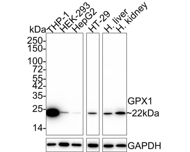 Glutathione Peroxidase 1/GPX1 Antibody (A6-C0-B9-R), Novus Biologicals 100 μL | Buy Online | Novus Biologicals