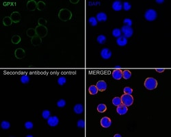 Glutathione Peroxidase 1/GPX1 Antibody (C5-A10-R), Novus Biologicals 100