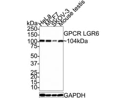Lgr6 Antibody (JE39-78), Novus Biologicals 100 &mu;L; Unconjugated:Antibodies,