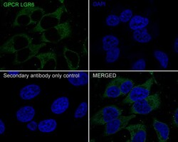 Lgr6 Antibody (JE39-78), Novus Biologicals 100 &mu;L; Unconjugated:Antibodies,