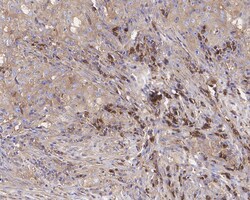 Lgr6 Antibody (JE39-78), Novus Biologicals 100 &mu;L; Unconjugated:Antibodies,