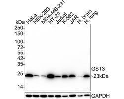 Glutathione S-Transferase pi 1/GSTP1 Antibody (11D5-R), Novus Biologicals