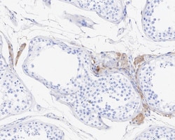 Glutathione S-Transferase pi 1/GSTP1 Antibody (11D5-R), Novus Biologicals