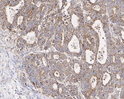 HADH Antibody (D10-E7-R), Novus Biologicals 100 &mu;L; Unconjugated:Antibodies,