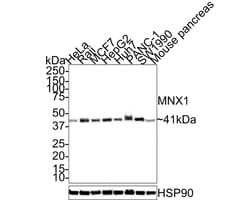 MNX1/HLXB9 Antibody (JE32-08), Novus Biologicals 100 &mu;L; Unconjugated:Antibodies,