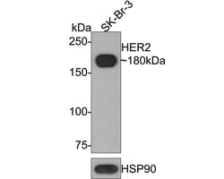 ErbB2/Her2 Antibody (PD00-99), Novus Biologicals 100 &mu;L; Unconjugated:Antibodies,
