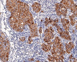ErbB2/Her2 Antibody (PD00-99), Novus Biologicals 100 &mu;L; Unconjugated:Antibodies,
