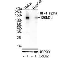 HIF-1 alpha Antibody (JE75-33), Novus Biologicals 100 &mu;L; Unconjugated:Antibodies,