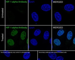 HIF-1 alpha Antibody (JE75-33), Novus Biologicals 100 &mu;L; Unconjugated:Antibodies,