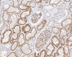 HIF-1 alpha Antibody (JE75-33), Novus Biologicals 100 &mu;L; Unconjugated:Antibodies,