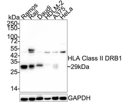 HLA DRB1 Antibody (JE60-43), Novus Biologicals 100 &mu;L; Unconjugated:Antibodies,