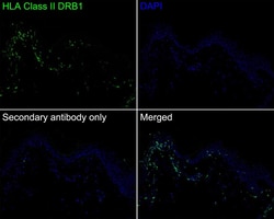 HLA DRB1 Antibody (JE60-43), Novus Biologicals 100 &mu;L; Unconjugated:Antibodies,