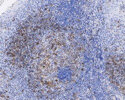 HLA DRB1 Antibody (JE60-43), Novus Biologicals 100 &mu;L; Unconjugated:Antibodies,