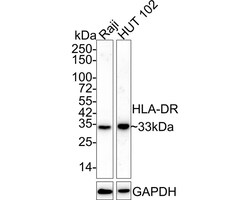 HLA-DR Antibody (10-D8-R), Novus Biologicals 100 &mu;L; Unconjugated:Antibodies,