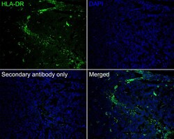HLA-DR Antibody (10-D8-R), Novus Biologicals 100 &mu;L; Unconjugated:Antibodies,