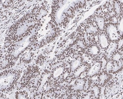 HSF1 Antibody (JE44-79), Novus Biologicals 100 &mu;L; Unconjugated:Antibodies,
