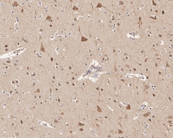 HSP90 beta Antibody (2-1-G3-R), Novus Biologicals 100 &mu;L | Buy Online | Novus Biologicals | Fisher Scientific