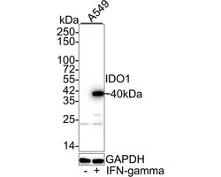 Indoleamine 2,3-dioxygenase/IDO Antibody (PD00-62), Novus Biologicals 100