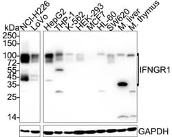 IFN-gamma R1/CD119 Antibody (JE40-50), Novus Biologicals 100 &mu;L; Unconjugated:Anticuerpos