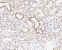 IFN-gamma R1/CD119 Antibody (JE40-50), Novus Biologicals 100 &mu;L; Unconjugated:Anticuerpos