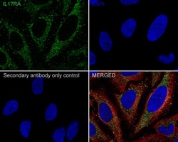 IL-17RA/IL-17R Antibody (JE35-89), Novus Biologicals 100 &mu;L; Unconjugated:Antibodies,