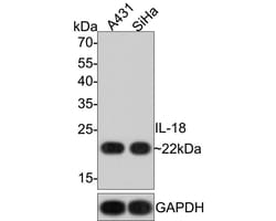 IL-18/IL-1F4 Antibody (PS01-06), Novus Biologicals 100 &mu;L; Unconjugated:Antibodies,