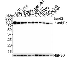 Jumonji/JARID2 Antibody (PSH01-32), Novus Biologicals 100 &mu;L; Unconjugated:Antikörper