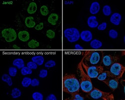 Jumonji/JARID2 Antibody (PSH01-32), Novus Biologicals 100 &mu;L; Unconjugated:Antikörper