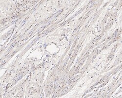 Jumonji/JARID2 Antibody (PSH01-32), Novus Biologicals 100 &mu;L; Unconjugated:Antikörper