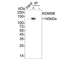 Lysine (K)-specific Demethylase 5B/KDM5B/JARID1B Antibody (PSH03-97), Novus