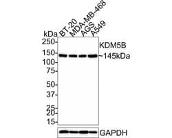 Lysine (K)-specific Demethylase 5B/KDM5B/JARID1B Antibody (PSH03-97), Novus