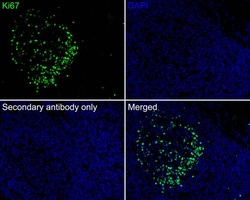 Ki67/MKI67 Antibody (SR00-02), Novus Biologicals 100 &mu;L; Unconjugated:Antibodies,