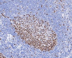 Ki67/MKI67 Antibody (SR00-02), Novus Biologicals 100 &mu;L; Unconjugated:Antibodies,