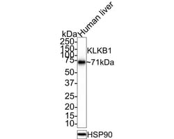 Plasma Kallikrein/KLKB1 Antibody (JE31-29), Novus Biologicals 100 &mu;L;