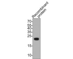 KMT2D Antibody, Novus Biologicals 100 &mu;L; Unconjugated:Antibodies, Polyclonal