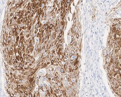KSR1 Antibody (JE57-75), Novus Biologicals 100 &mu;L; Unconjugated:Antibodies,