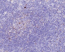 LAG-3 Antibody (PSH0-43), Novus Biologicals 100 &mu;L | Buy Online | Novus Biologicals | Fisher Scientific