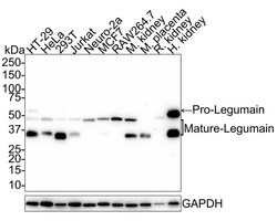 Legumain/Asparaginyl Endopeptidase Antibody (JE35-56), Novus Biologicals
