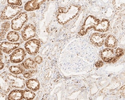 Legumain/Asparaginyl Endopeptidase Antibody (JE35-56), Novus Biologicals