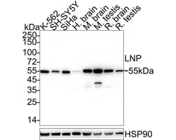 Lunapark Antibody (11-1-R), Novus Biologicals 100 &mu;L; Unconjugated:Antibodies,